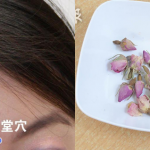 頭痛發作？中醫2招K.O.壓力性頭痛 按穴、飲花茶紓緩有法